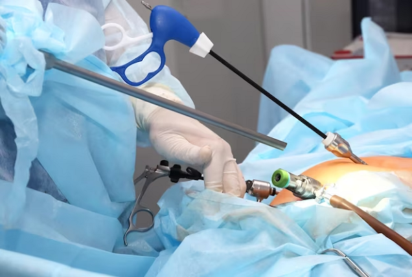 Laparoscopic Gall Bladder Surgery