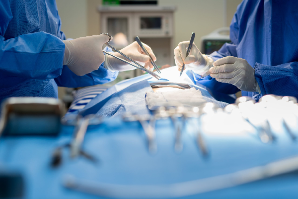 Hiatus Hernia Surgery